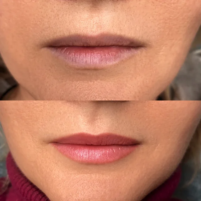 Usta · Natural Lips