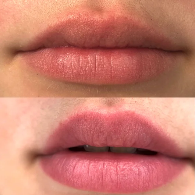 Usta · Natural Lips