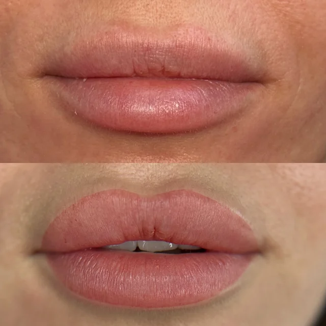 Usta · Natural Lips 02